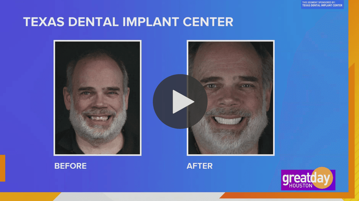 Learn about Texas Dental Implant Center on Local Spotlight