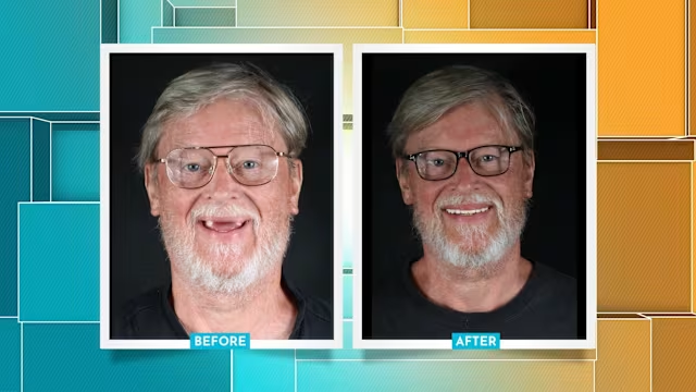 Dental Transformation: Before and After Success