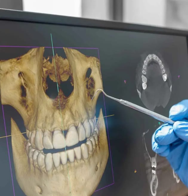 If you’ve been told you don’t have enough bone for dental